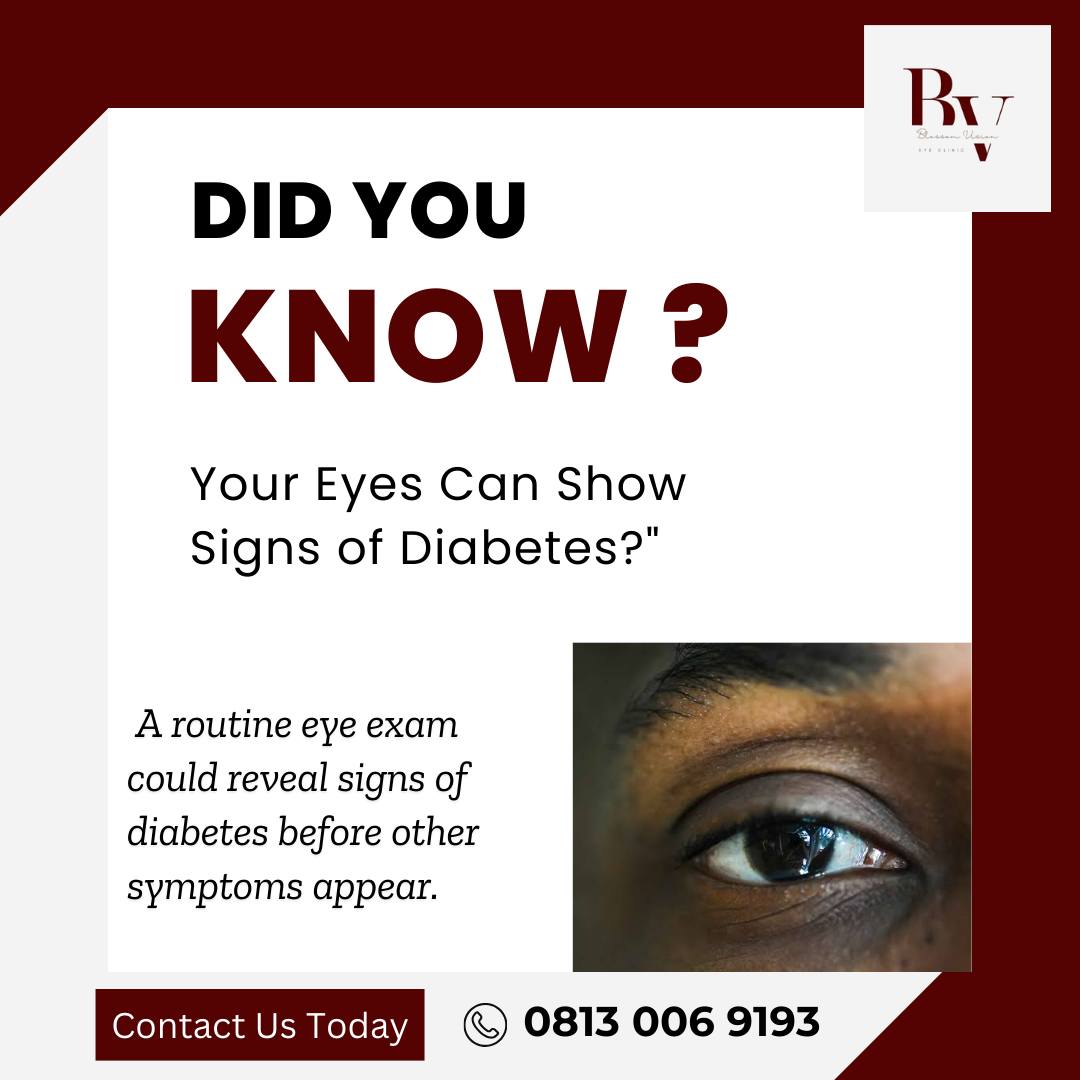 Your Eyes Can Show Signs of Diabetes?👁